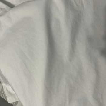 Kumaş Hatalı Gelen Tişört İçin İade Veya Değişim Talebi