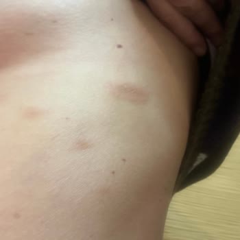 Aldığım Ürün Ciddi Alerjik Reaksiyonlara Yol Açtı İade Talep Ediyorum