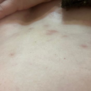 Aldığım Ürün Ciddi Alerjik Reaksiyonlara Yol Açtı İade Talep Ediyorum