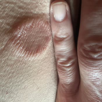 Aldığım Ürün Ciddi Alerjik Reaksiyonlara Yol Açtı İade Talep Ediyorum