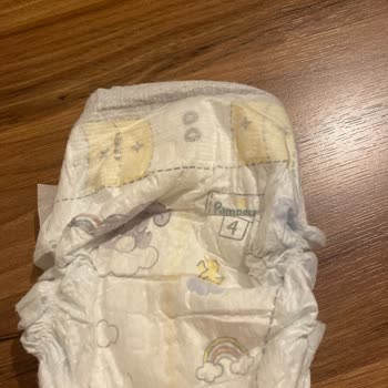 Prima Premium Care Bebek Bezlerinde Kalite Sorunu Ve Mağduriyet