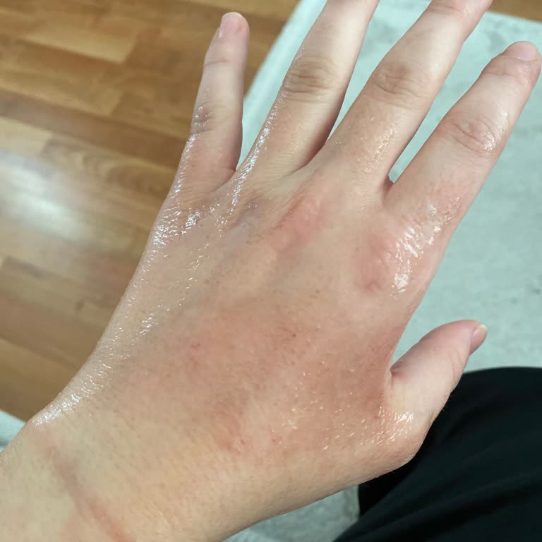 Stanley Termosun Patlaması Sonucu Yaşanan Güvenlik Sorunu ve Mağduriyet