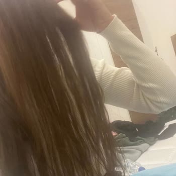 Saç Kaynak İşlemi Sonrası Dökülen Saçlar Ve Karşılıksız Garanti Mağduriyeti