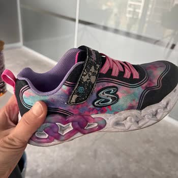 Kısa Sürede Deforme Olan Ayakkabıya Skechers'dan Çözüm Bekliyorum