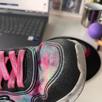 Kısa Sürede Deforme Olan Ayakkabıya Skechers'dan Çözüm Bekliyorum