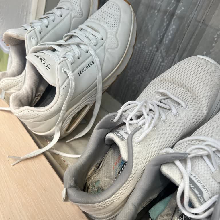 Skechers Ayakkabıda Deformasyon Ve Müşteri Hizmetlerinde Hayal Kırıklığı