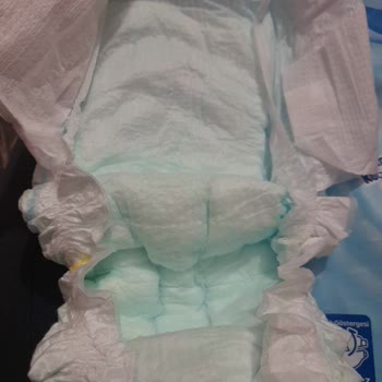 Molfix Bebek Bezlerinde Sızdırma Ve Pişik Sorunu Yaşadık