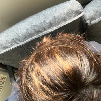 Saç Boyama İşleminde İstenmeyen Sonuç Ve Ücret İadesi Talebi