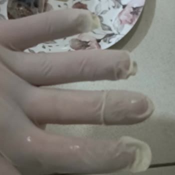 Tehlikeli Ürün Teslimatı Ve Müşteri Hizmetlerinden Yanıt Alamama Mağduriyeti