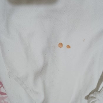 Arızalı Çamaşır Makinesi Ve Yetersiz Servis Hizmeti Nedeniyle Mağduriyet