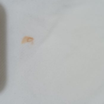 Arızalı Çamaşır Makinesi Ve Yetersiz Servis Hizmeti Nedeniyle Mağduriyet