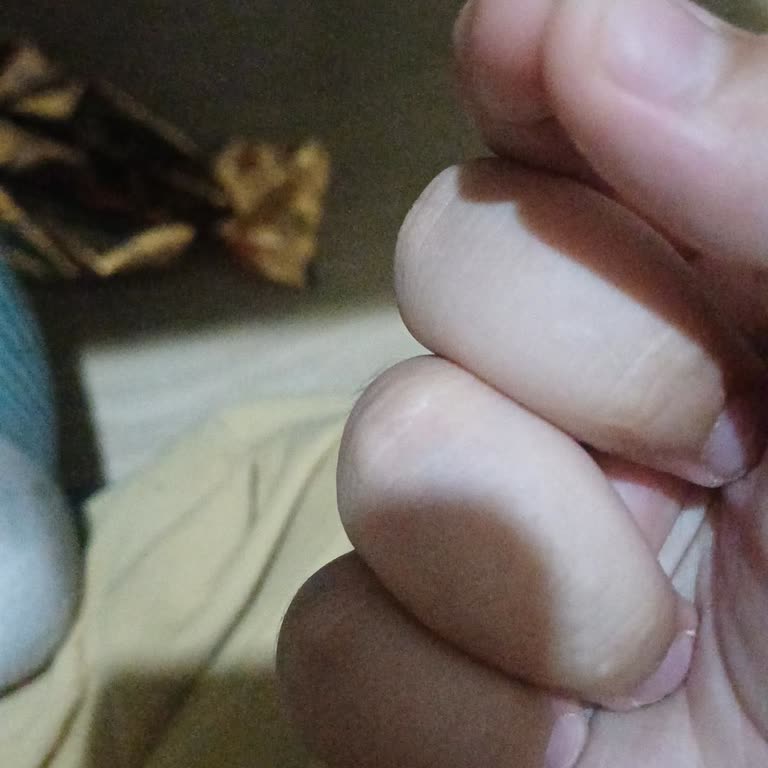 Halley İçinde Metal Parça Buldum Sağlığım Tehlikeye Girdi