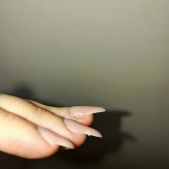 Hijyen Eksikliği Ve Yetersiz Hizmet Nedeniyle Mağduriyet