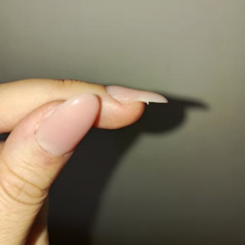 Hijyen Eksikliği Ve Yetersiz Hizmet Nedeniyle Mağduriyet