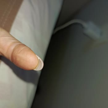 Hijyen Eksikliği Ve Yetersiz Hizmet Nedeniyle Mağduriyet