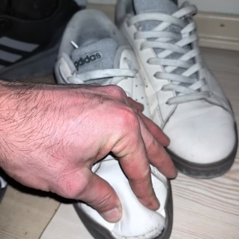 3 Ayda Açılan Adidas Ayakkabıma Garanti Reddi!