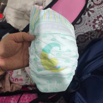 Jenny & Willy Bebek Bezlerinde Sürekli Kopan Cırt Cırtlar Mağduriyet Yaratıyor