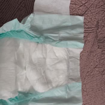 Jenny & Willy Bebek Bezlerinde Sürekli Kopan Cırt Cırtlar Mağduriyet Yaratıyor