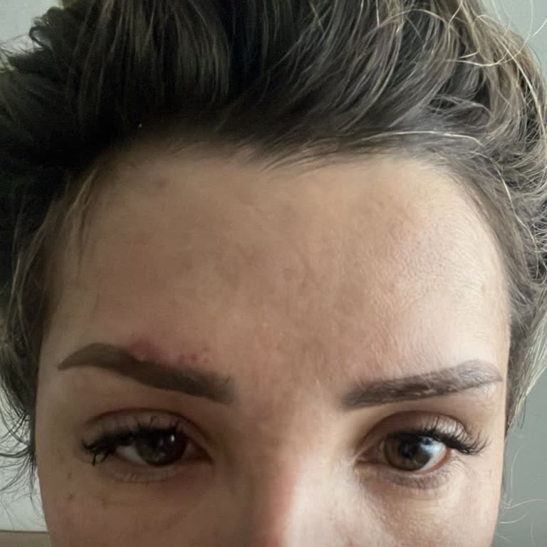 Kalıcı Kaş İşleminde Fiyasko: Mağduriyet Ve İlgisizlik!