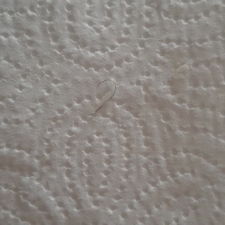 Süt Paketlerinde Kıl Çıkması Hijyen Endişesi Yarattı