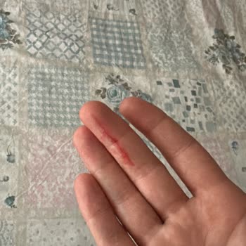 Yatak Takımında Ürün Ve Servis Sorunu