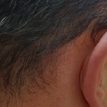 Saç Bakımında Yaşadığım Sağlık Sorunları Ve Yetersiz İletişim Mağduriyeti