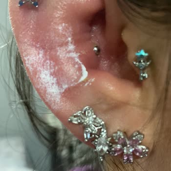 Bipiercing Yanlış Delim Sonrası Sağlık Sorunları ve İlgisiz Hizmet