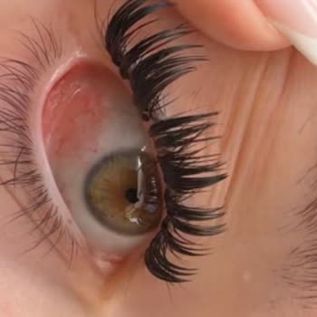 İpek Kirpik Uygulaması Sonrası Gözümde Ciddi Sağlık Sorunu Yaşadım