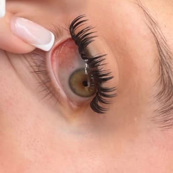 İpek Kirpik Uygulaması Sonrası Gözümde Ciddi Sağlık Sorunu Yaşadım