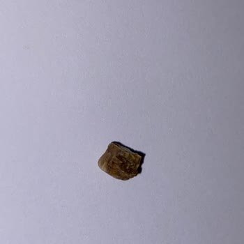 Baklava İçinden Yabancı Cisim Çıkması Ve Mağduriyet