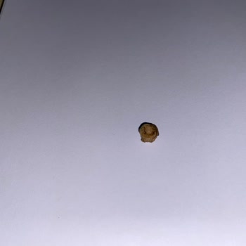 Baklava İçinden Yabancı Cisim Çıkması Ve Mağduriyet