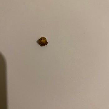 Baklava İçinden Yabancı Cisim Çıkması Ve Mağduriyet