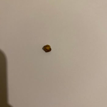 Baklava İçinden Yabancı Cisim Çıkması Ve Mağduriyet