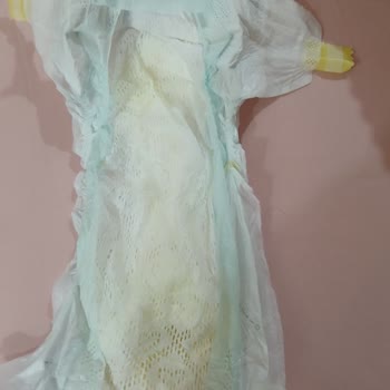 Prima Bebek Bezinde Topaklanma Ve Cilt Tahrişi Sorunu