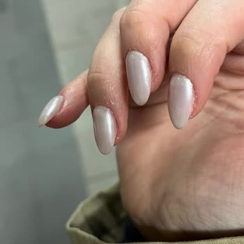 Hijyen Eksikliği Ve İlgisiz Davranış Nedeniyle Sağlığım Tehlikeye Girdi