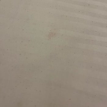 Hijyen Sorunu Ve Yetersiz Müşteri Hizmeti Nedeniyle Mağduriyet