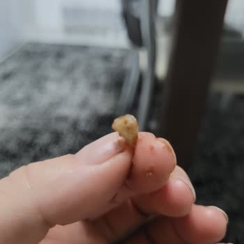 Eti Kakaolu Fındıklı Kekten Çıkan Yabancı Madde Dişimi Zedeledi