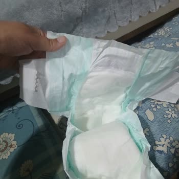 Jenny Willy Bebek Bezinde Bant Değişikliği Sonrası Sızdırma Sorunu