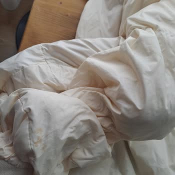 Zara'dan Aldığım Çocuk Montunda Leke Ve Deformasyon Sorunu