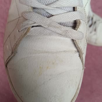 Adidas Stan Ayakkabıda Kısa Sürede Çatlama Ve Taban Sorunu Yaşadım