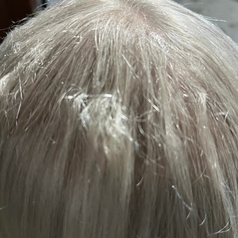 Aura Design Studio | Kahramanmaraş'ta Saçım Mahvoldu Mağdur Oldum