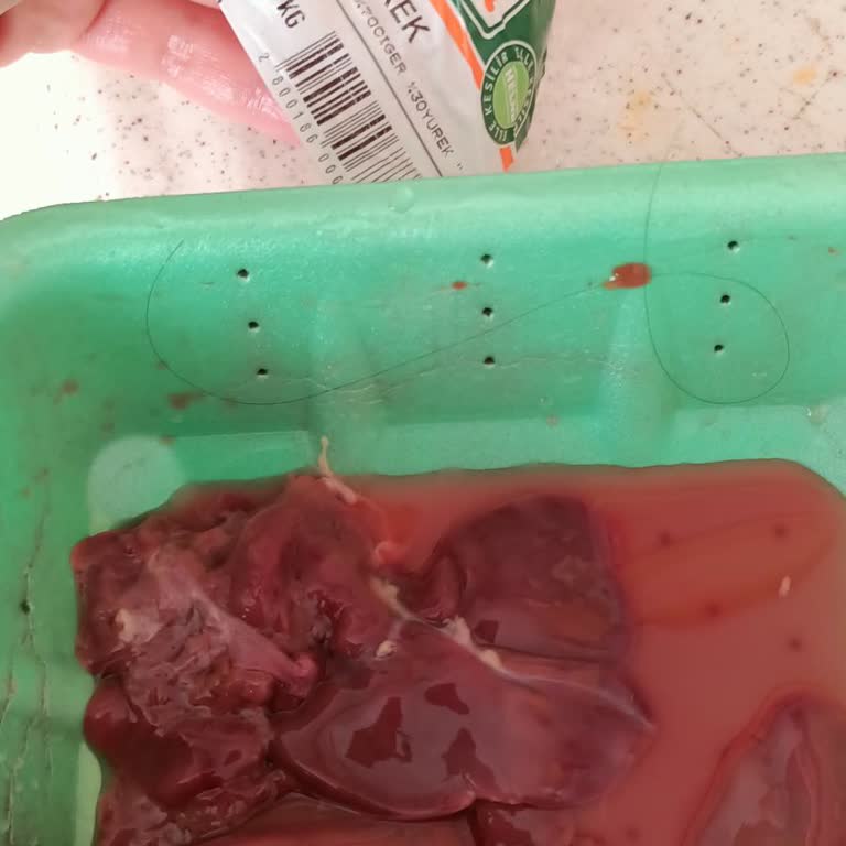 Tavuk Ciğerinden Çıkan Saç Ve Müşteri Hizmetlerinde Yaşanan İletişim Sorunu