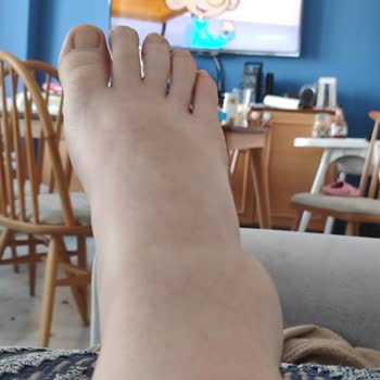 Hastane Otoparkında Güvensizlik Ve İlgisiz Personel Mağduriyeti