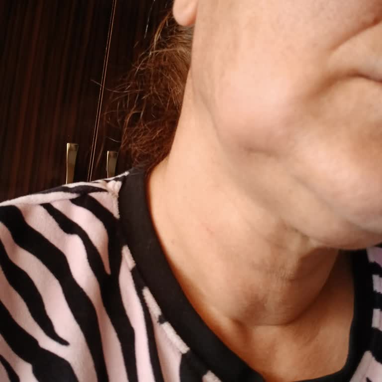 Düzce Atatürk Devlet Hastanesi Diş Çekimi Sonrası Mağduriyet Ve Hijyen Eksikliği