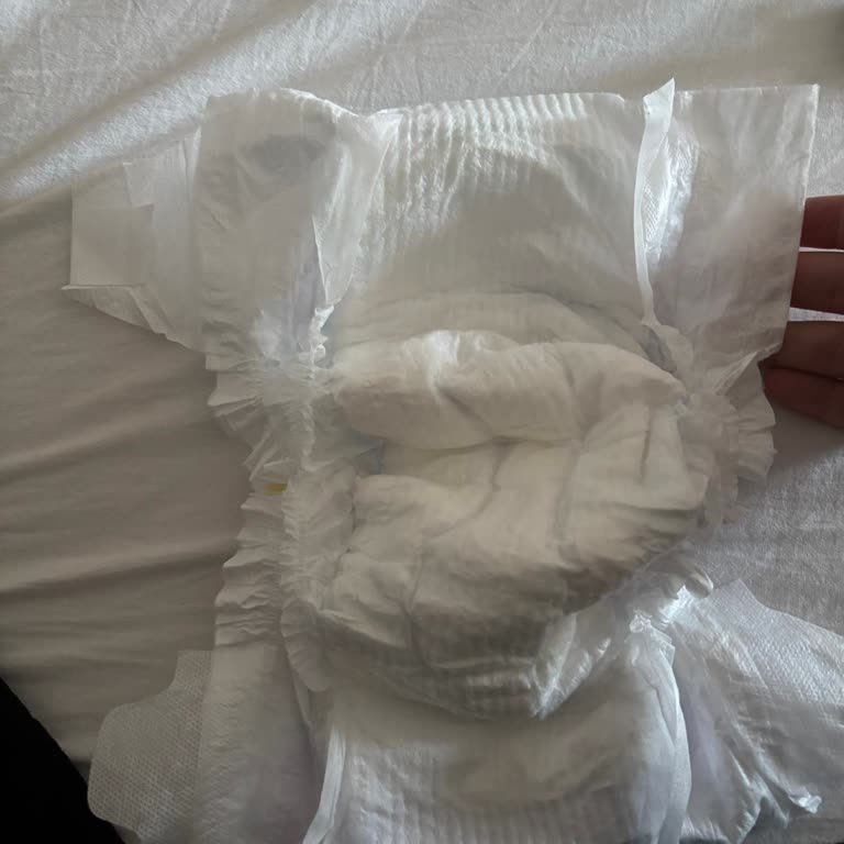 Molfix Bebek Bezinde Eksik Bant Sorunu Ve Kalite Endişesi