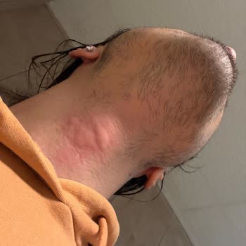 Otel Odasında Hijyen Ve Güvenlik Faciası, Sağlığım Bozuldu