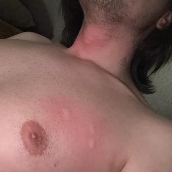 Otel Odasında Hijyen Ve Güvenlik Faciası, Sağlığım Bozuldu