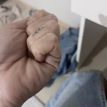 Anti Hair Loss Toniği Saç Dökülmemi Artırdı Çözüm Alamadım