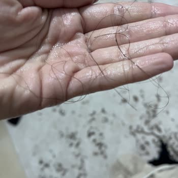 Anti Hair Loss Toniği Saç Dökülmemi Artırdı Çözüm Alamadım