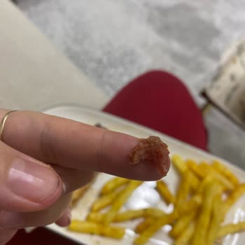 Siparişimde Çiğ Köfte Sorunu Ve Ücret İadesi Talebi